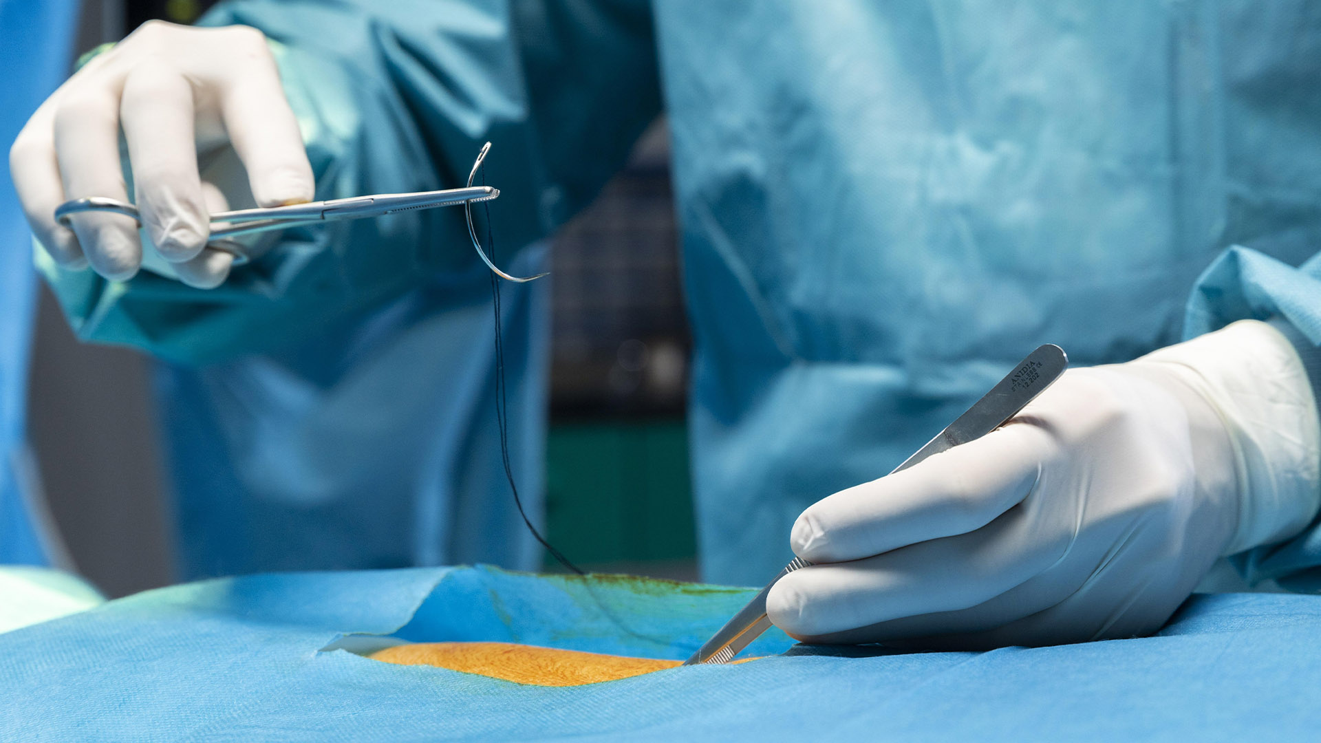 Dikiş Atma ve Alma Hizmeti